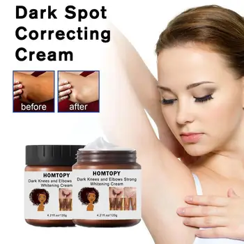 Dark Spot Corrector Whiten Cream 120g Skin Moisturizing Brightening Bleaching Lightening Knee Lotion Body Elbow Underarm Ch E6D0